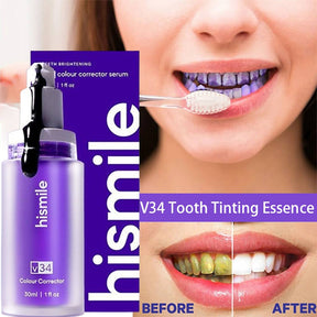 ✨ New HighSmile Teeth Whitening – Brighten Your Smile Instantly! ✨